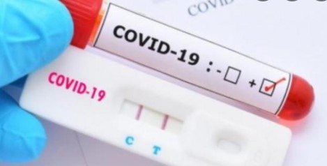 1496 нови случая на коронавирус у нас, положителни са 24% от изследваните